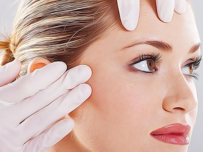 Чек-лифтинг