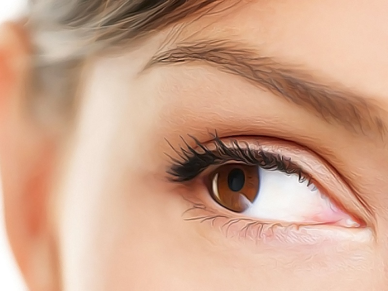 Кантопластика