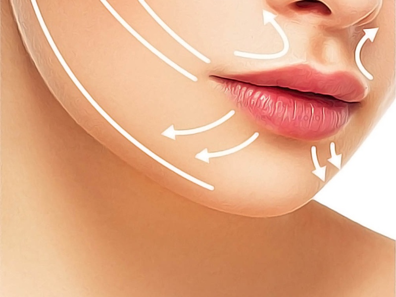 Контурная пластика лица