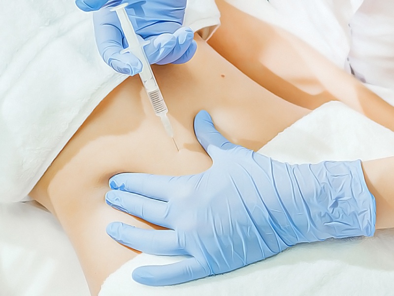 Липофилинг груди, ягодиц