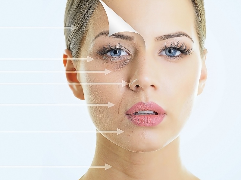 Какие есть безоперационные методы подтяжки лица?