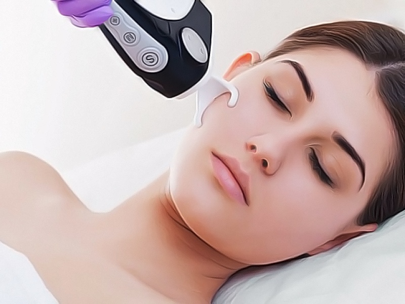 Лазерная шлифовка лица: что нужно знать