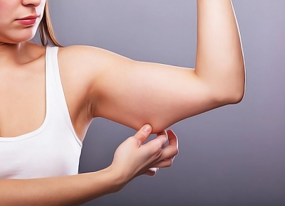 Подтяжка рук: брахиопластика