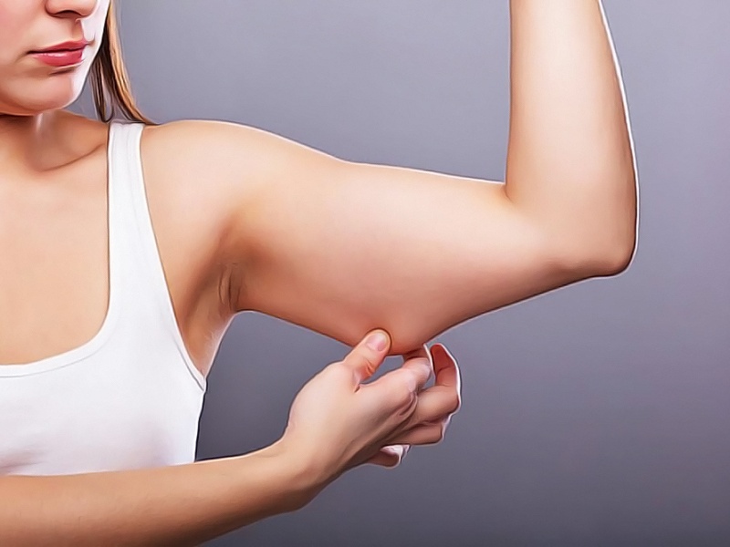 Подтяжка рук: брахиопластика