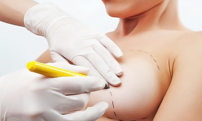 Липофилинг или импланты