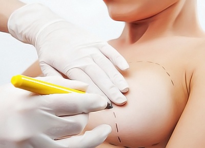 Липофилинг или импланты