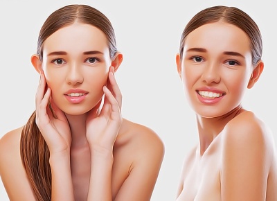 Когда не поздно сделать отопластику