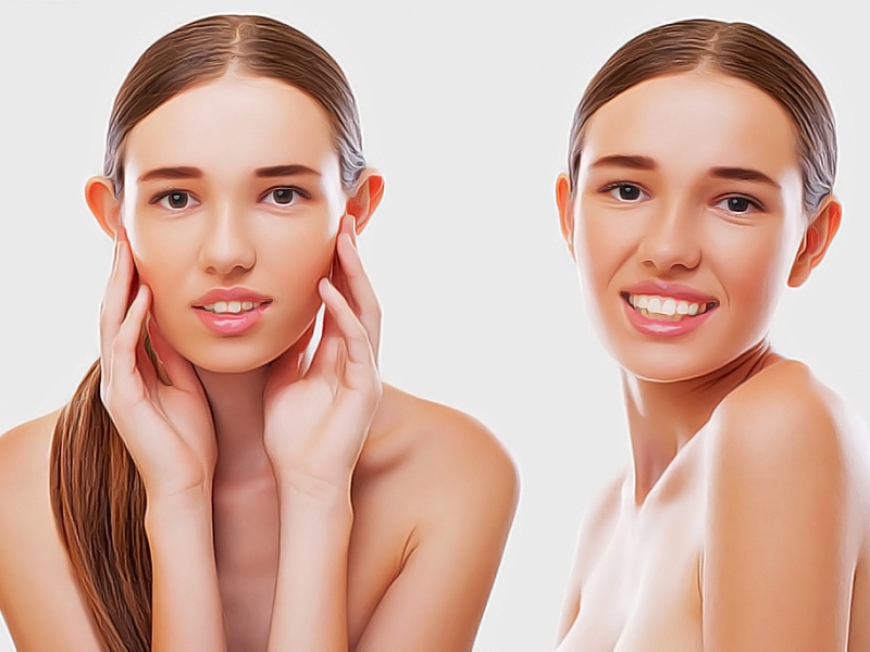 Когда не поздно сделать отопластику