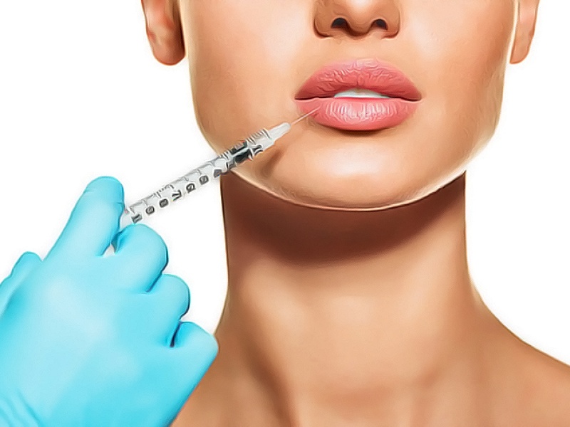 Современные техники увеличения губ