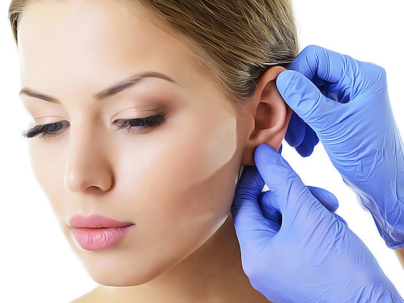 Отопластика и ее особенности