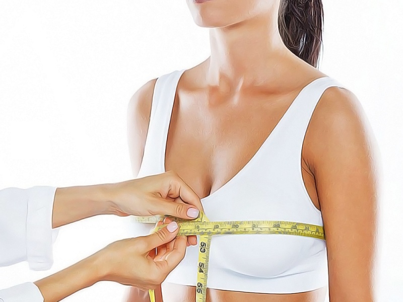 Редукционная маммопластика (уменьшение груди)