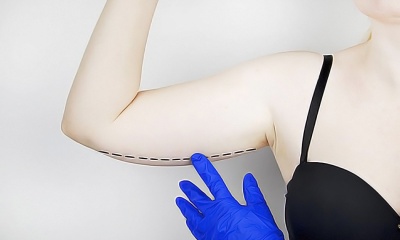 Брахиопластика - что это и зачем нужно