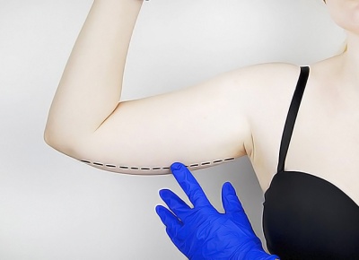 Брахиопластика - что это и зачем нужно