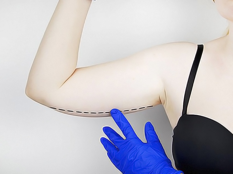 Брахиопластика - что это и зачем нужно