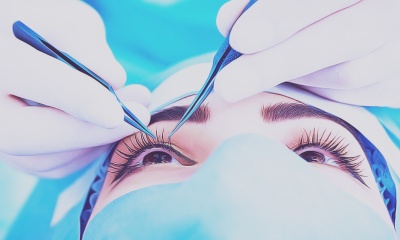 Верхняя блефаропластика