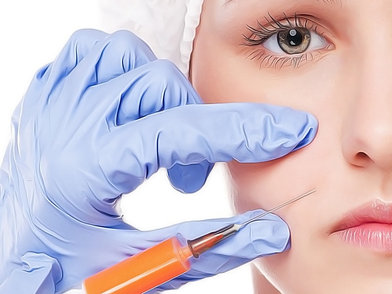 Липофилинг - что нужно знать