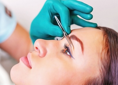 Устранение возрастных или врожденных дефектов в зоне век. Блефаропластика