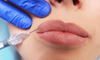 Как увеличить губы без вреда для здоровья.