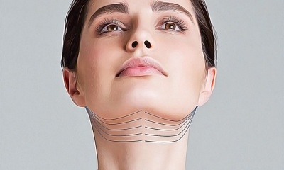 Подтяжка шеи. Как убрать следы возраста
