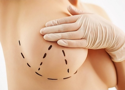Увеличение или подтяжка груди: что выбрать?