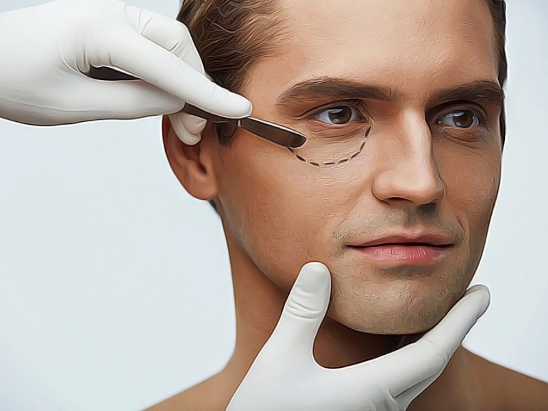 Пластические операции для мужчин