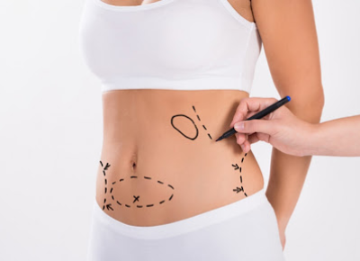 Опасна ли липосакция?