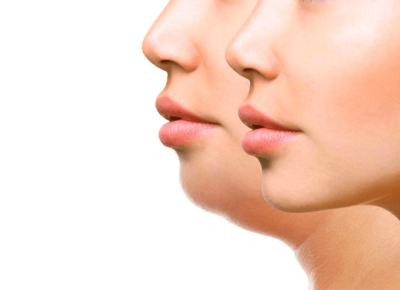 Жировые ловушки на лице