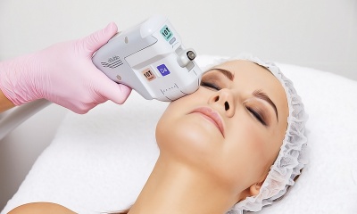 Что такое SMAS подтяжка лица