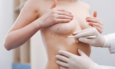 Швы и шрамы после увеличения груди