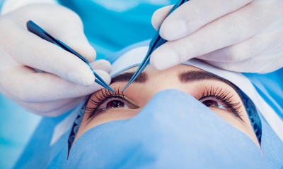 Что выбрать – лазерную или хирургическую блефаропластику