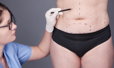 Какие проблемы решает липосакция