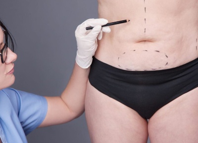 Какие проблемы решает липосакция