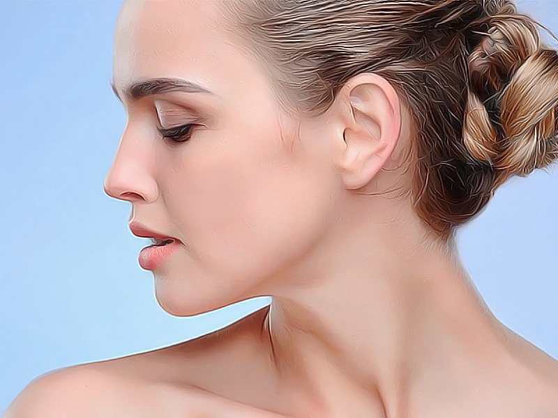 Отопластика при микротии